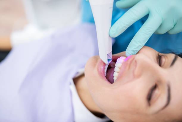 Intraoralni skener Shining Aoralscan Elite